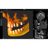 Acteon ACTEON X-MIND PRIME 3D PANOREX + CEPH + CONE BEAM 