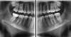 Vatech VATECH PaX-i Green CT Panorex Cone Beam
