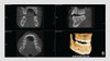 Vatech VATECH PaX-i Green CT Panorex Cone Beam