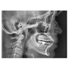 Vatech VATECH PaX-i Green CT Panorex + Ceph + Cone Beam - 15x15 
