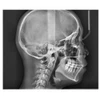 Vatech VATECH PaX-i Green CT Panorex + Ceph + Cone Beam - 15x15 