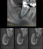  DEXIS OP 3D Pro Panorex + Cone Beam - 15x8 FOV 