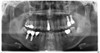 SIRONA ORTHOPHOS XG 3D Panorex Ceph Cone Beam