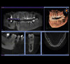 SIRONA ORTHOPHOS XG 3D Panorex Cone Beam SIRONA ORTHOPHOS XG 3D Panorex Cone Beam