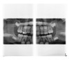 SIRONA ORTHOPHOS XG 3D Panorex Cone Beam SIRONA ORTHOPHOS XG 3D Panorex Cone Beam