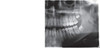 SIRONA ORTHOPHOS XG 3D Panorex Cone Beam SIRONA ORTHOPHOS XG 3D Panorex Cone Beam