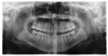 SIRONA ORTHOPHOS XG 3D Panorex Cone Beam SIRONA ORTHOPHOS XG 3D Panorex Cone Beam