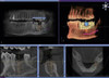 SIRONA ORTHOPHOS XG 3D Panorex Cone Beam SIRONA ORTHOPHOS XG 3D Panorex Cone Beam