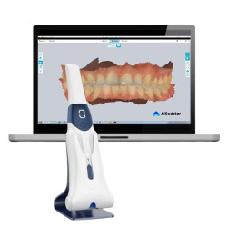 Alliedstar ALLIEDSTAR AS 200E WIRELESS INTRAORAL SCANNER + NEW LAPTOP  Alliedstar ALLIEDSTAR AS 200E WIRELESS INTRAORAL SCANNER + NEW LAPTOP