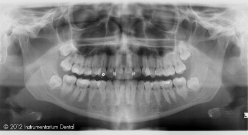 panoramic radiograph scan cdr dicom