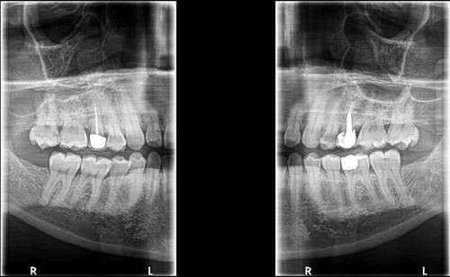 Carestream CS 8100 3D Panorex + Cone Beam | Renew Digital