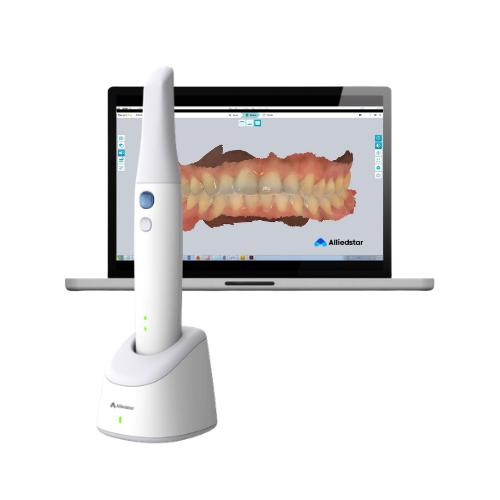 Alliedstar ALLIEDSTAR SENSA WIRELESS INTRAORAL SCANNER + LAPTOP [5YR WARRANTY] 