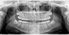 Kodak 8000 delivers crystal-clear standard adult panoramic dental X-ray images in seconds.