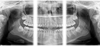 Kodak 8000 delivers superb segmented panoramic dental X-ray images.