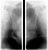 Capture TMJ views with Kodak 8000 panoramic dental X-ray.