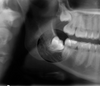 Kodak dental imaging software provides features such as zoom and filter to Kodak 8000 dental digital X-ray images, facilitating diagnosis.
