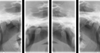 Capture TMJ views with Kodak 8000 panoramic dental X-ray.