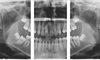 Kodak 9000 panoramic system segmented panoramic.