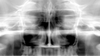 Kodak 9000 panoramic system maxillary sinus panoramic.