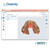 Owandy IOS Intra-oral Scanner with Laptop by www.trinitydentalequipment.com