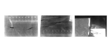 Lead Apron Inspection & Replacement: What Programs Should Require