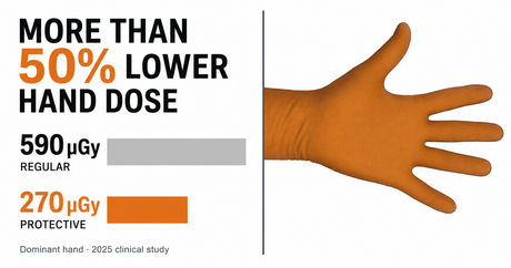 Protection Glove's Impact Hand Radiation Dosage 