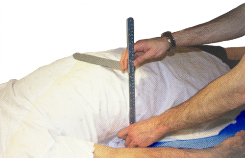 24-123-205 - Aluminum Bariatric Body Caliper