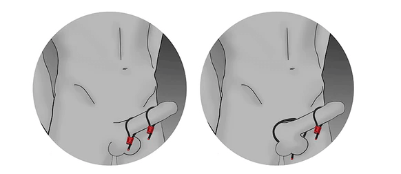 Electrastim Prestige Cock Ring loops