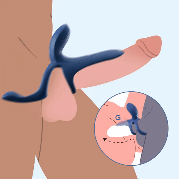 Pivot ring