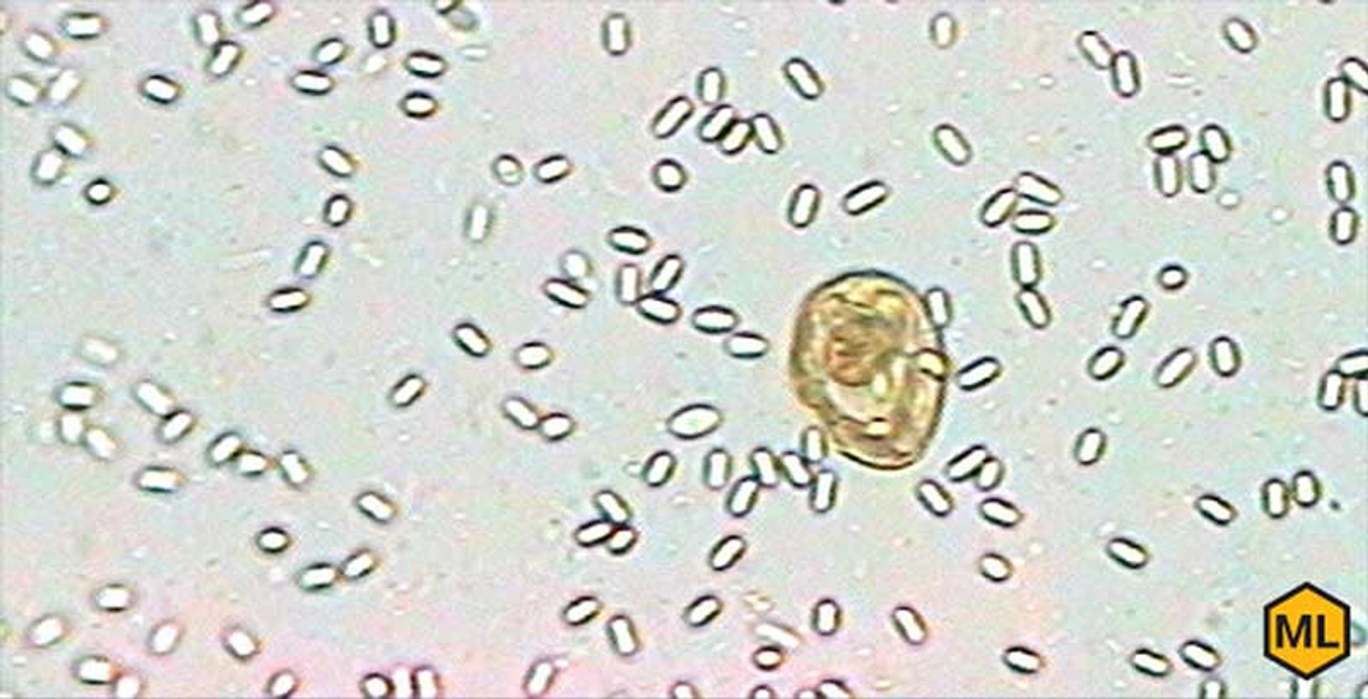 Diagnosing and Treating Nosema in Honey Bees thumbnail image