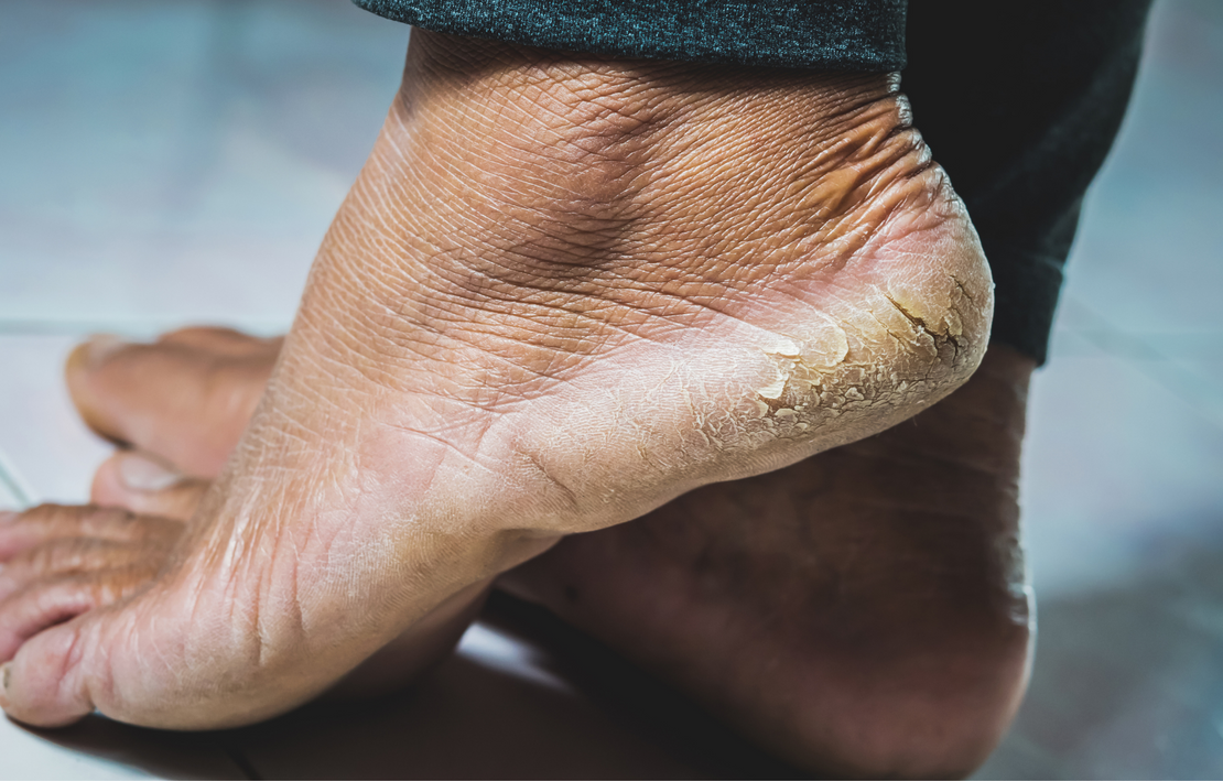 3 Reasons to Maintain Foot Protection Around The House 3 Reasons to Maintain Foot Protection Around The House