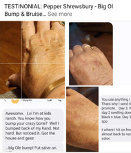 ​TESTIMONIAL: Pepper Shrewsbury - Big Ol Bump & Bruise Pepper