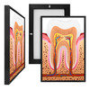 MINI98066 Tooth Diagram, Framed UV Poster Board