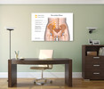 98052 The Lumbar Plexus, Acrylic Glass Art