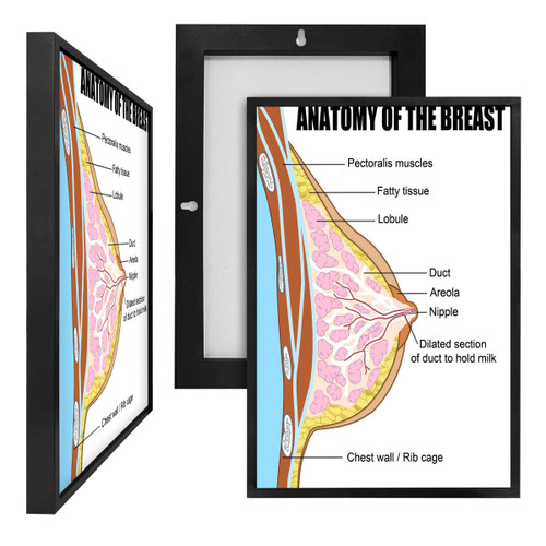 MINI98026 Anatomy of the Breast, Framed UV Poster Board