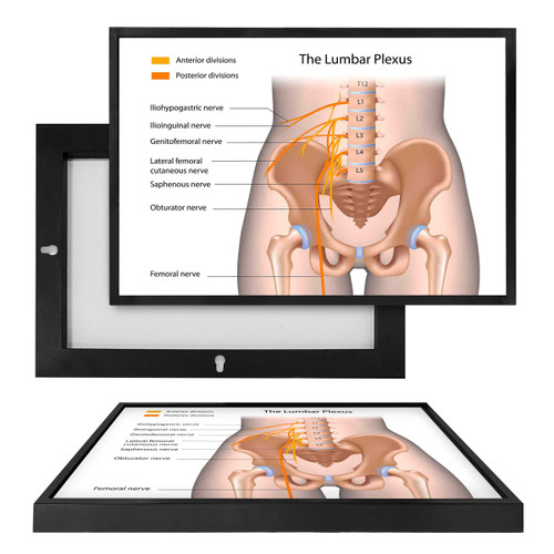 MINI98052 The Lumbar Plexus, Framed UV Poster Board