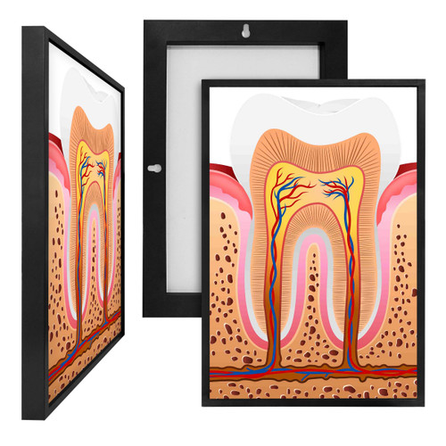 MINI98066 Tooth Diagram, Framed UV Poster Board