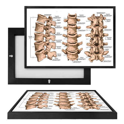 MINI98080 Vertebrae, Framed UV Poster Board