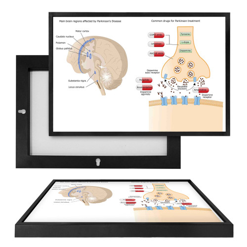 MINI98083 Parkinson's, Framed UV Poster Board