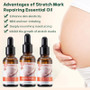 Stretch Marks Remover Essential Oil Pregnancy Maternity Body New Old Stretch Mark Removal Serum Increase Elasticity of Skin Care
