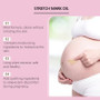 Stretch Marks Remover Essential Oil Pregnancy Maternity Body New Old Stretch Mark Removal Serum Increase Elasticity of Skin Care