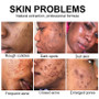 Face Care Turmeric Travel Women Moisturizer Private Label Skincare African Skin Anti Acne Whitening Skin Care Set