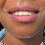 RACHELZ Fashion CZ Stone Vertical Bar Teeth Grillz Braces Hip Hop 4 Zircon Tooth Caps Dental Grills For Women Men Jewelry