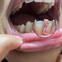 RACHELZ Fashion CZ Stone Vertical Bar Teeth Grillz Braces Hip Hop 4 Zircon Tooth Caps Dental Grills For Women Men Jewelry