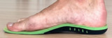 How XSTANCE actually heals your feet