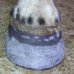 Equicast on the foot