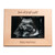 Ultrasound Picture Frame in landscape orientation
