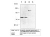 Napsin A (TMU-Ad02) Anti-Human Mouse IgG MoAb