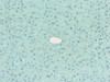 Anti-Poly (ADP-ribose) (10H) Mouse IgG MoAb