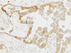 Anti-DPD (ADPYDMAB) Mouse IgG MoAb